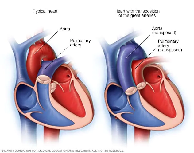 Finding out about Congenital Heart Defect